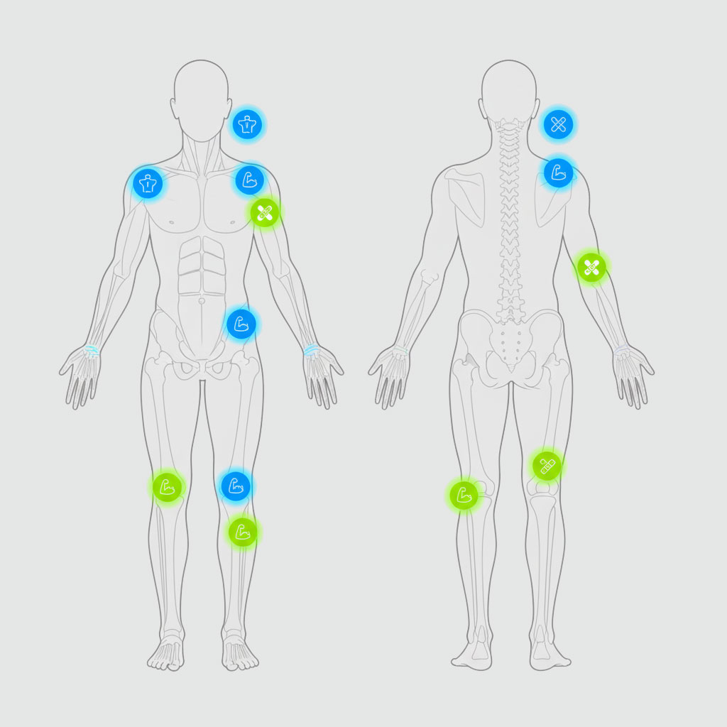 Sistemas super inductivo