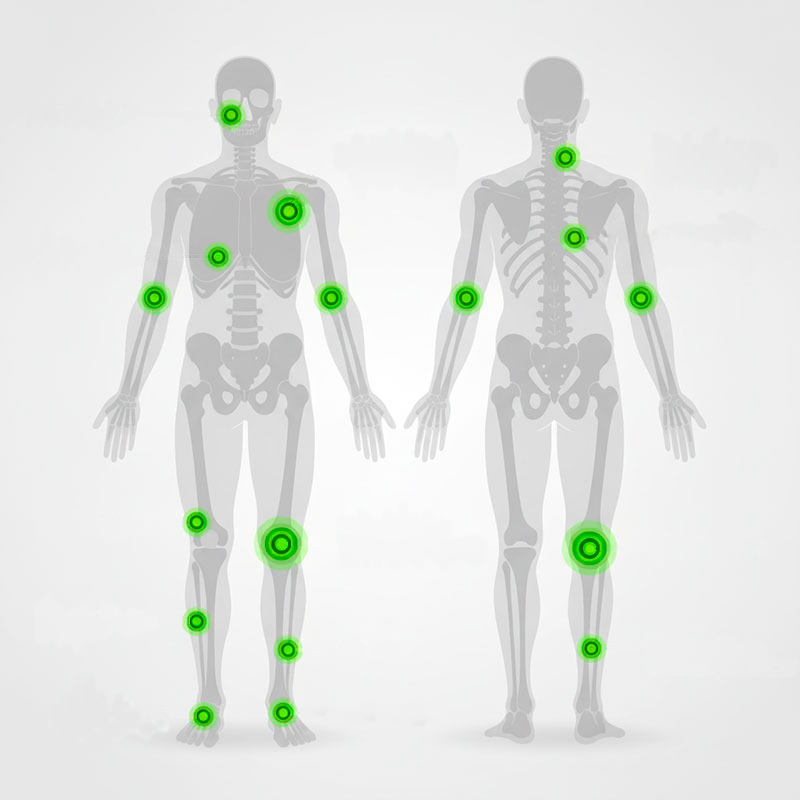 Electrolisis percutanea