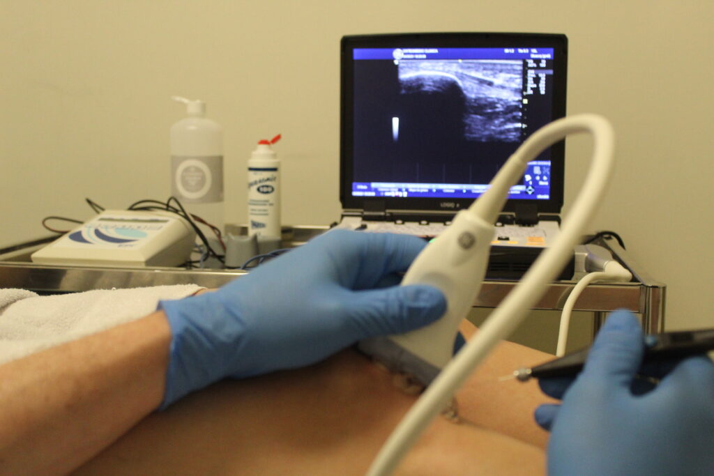 Electrolisis percutanea